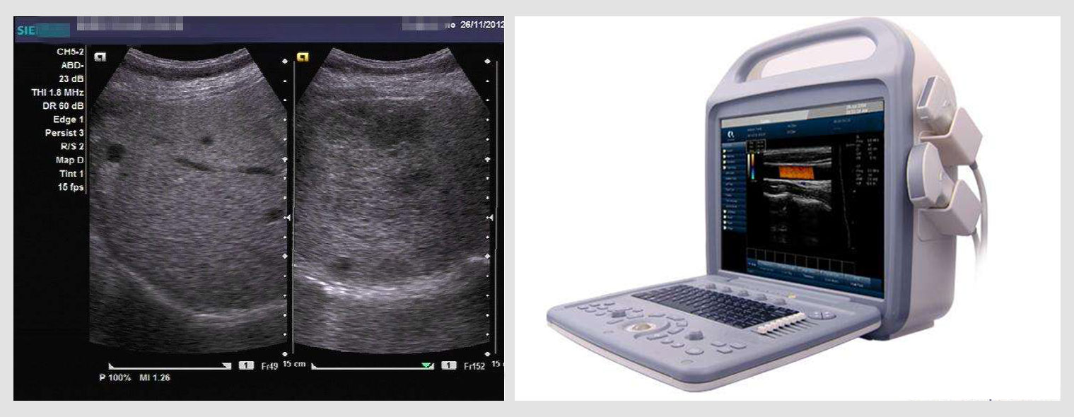 1575513217978217.jpg 1575513217978217.jpg