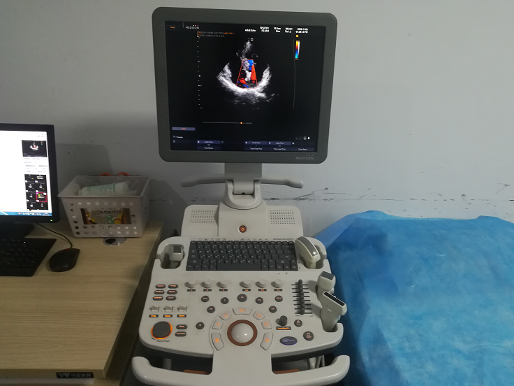 1576737903265357.png 超声1.png