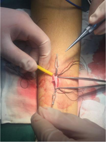 1584003889545526.png 图片4.png