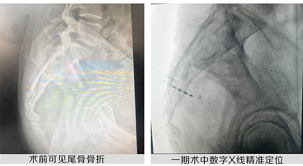 1667550018432259.jpg gai-3.jpg