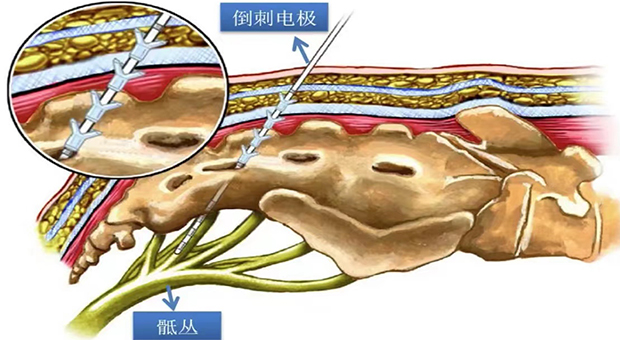 1667550244272308.jpg gai-6.jpg