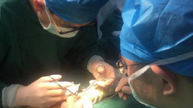 成人快手
开展首例透析患者自体动静脉内瘘成形术