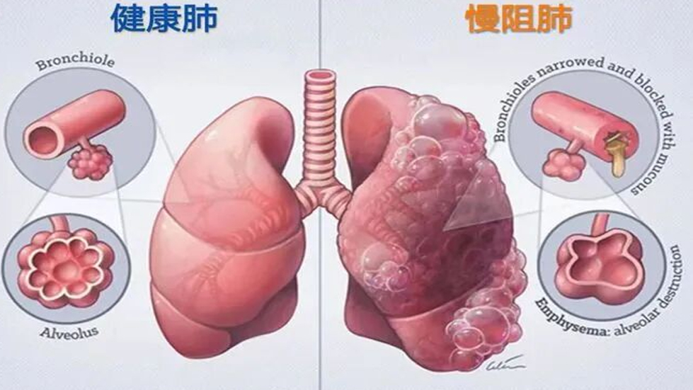 【成人快手动态
】了解你的肺功能
